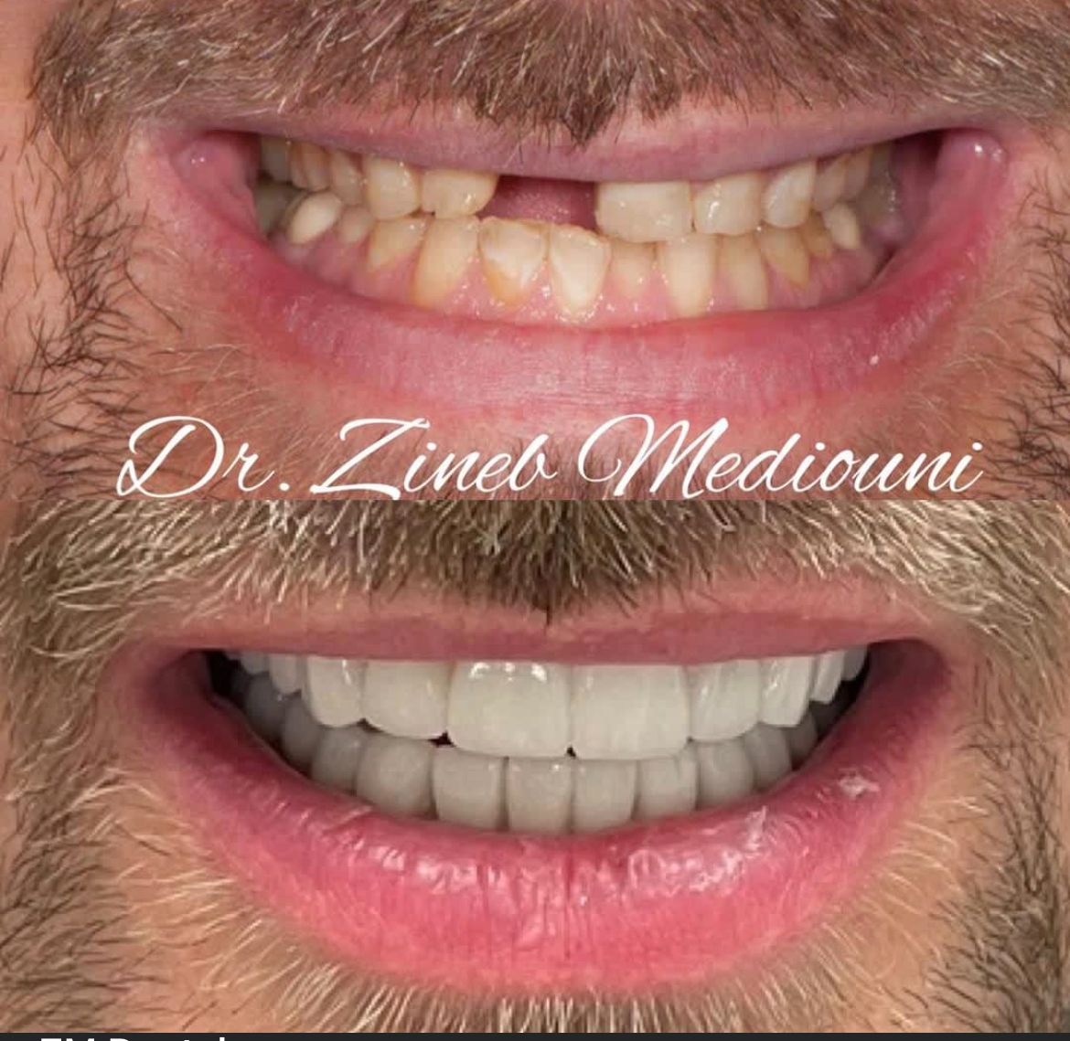 Smile Image Smile Image