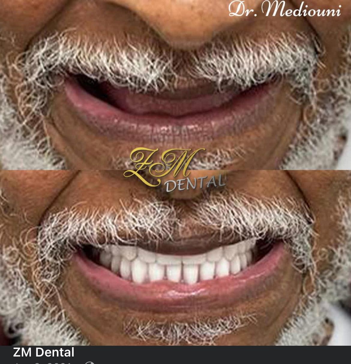 Smile Image Smile Image