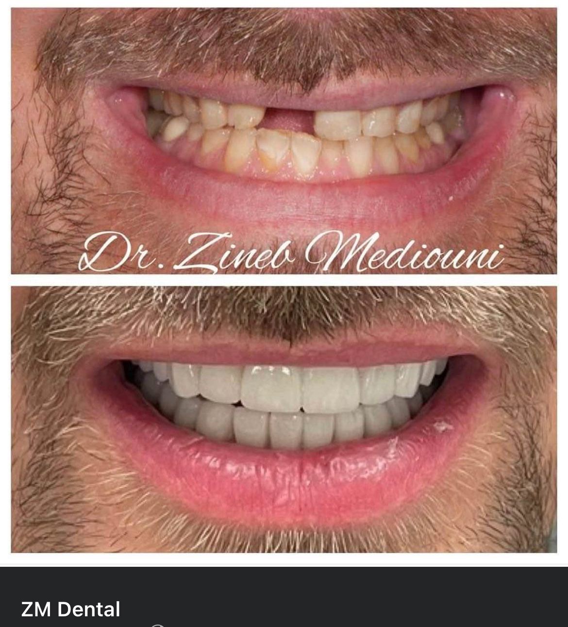 Smile Image Smile Image