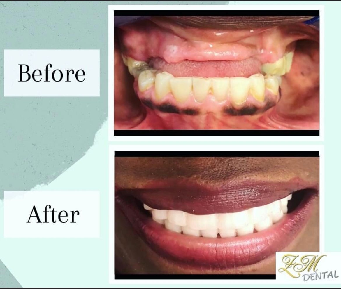 Smile Image Smile Image
