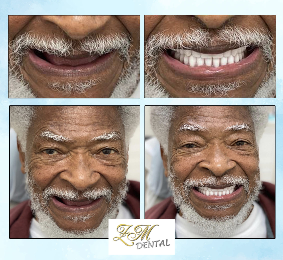 Smile Image Smile Image